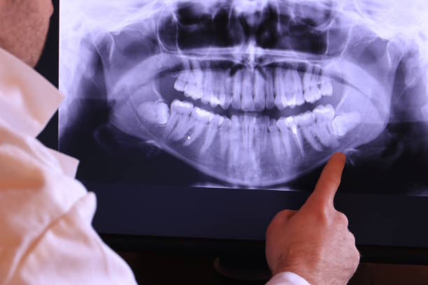 Best Emergency Dentist for Knocked-Out Tooth in Rock Island, IL