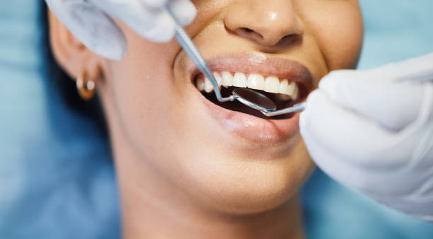 Best Emergency Dentist for Lost Fillings or Crowns in Rock Island, IL